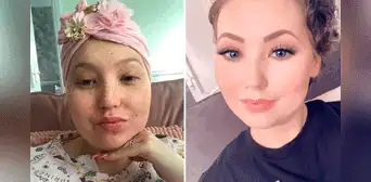 Joven británica pensó que le dolía el pecho por estrés y descubrió que tenía cáncer