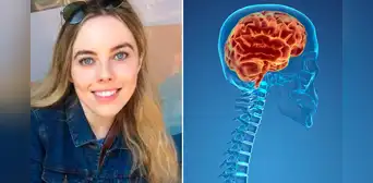 El curioso caso de Emily Balfour: rara condición hace que su cerebro se deslice por su columna El curioso caso de Emily Balfour: rara condición hace que su cerebro se deslice por su columna