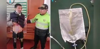 Sujeto fingía tener una enfermedad incurable para estafar en Arequipa y Cusco Sujeto fingía tener una enfermedad incurable para estafar en Arequipa y Cusco