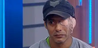 Comas: joven que perdió ojo el año pasado denuncia que empresa aún no se hace responsable