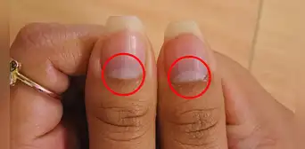 ¿Qué es la lúnula de las uñas y por qué no todos lo tienen? ¿Qué es la lúnula de las uñas y por qué no todos lo tienen?