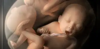 ¿Qué pasó con los bebés editados genéticamente en China? ¿Qué pasó con los bebés editados genéticamente en China?