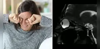 ¿Te rascas los ojos con frecuencia? Médicos muestran las peligrosas consecuencias ¿Te rascas los ojos con frecuencia? Médicos muestran las peligrosas consecuencias