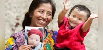 Regalemos sonrisas: inician colecta anual para apoyar a pacientes con fisura labial y paladar hendido Regalemos sonrisas: inician colecta anual para apoyar a pacientes con fisura labial y paladar hendido
