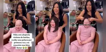 Niña que sufre de alopecia se pone peluca por primera vez y su reacción se vuelve viral: “Me hizo llorar” Niña que sufre de alopecia se pone peluca por primera vez y su reacción se vuelve viral: “Me hizo llorar”