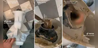 No pasaba el agua por su inodoro y al sacarlo encontraron algo inédito: ¡una dentadura postiza! No pasaba el agua por su inodoro y al sacarlo encontraron algo inédito: ¡una dentadura postiza!