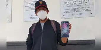 Arequipa: padre pide apoyo para salvarle la pierna a su bebé de siete meses Arequipa: padre pide apoyo para salvarle la pierna a su bebé de siete meses