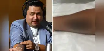Lucho Cuéllar se hizo tatuaje en honor al Grupo 5 y reaccionan: "Ni Christian Yaipén"
