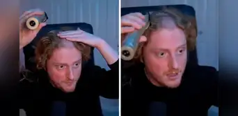 Hombre descubre abolladura en su cabeza por uso excesivo de auriculares al raparse en vivo Hombre descubre abolladura en su cabeza por uso excesivo de auriculares al raparse en vivo