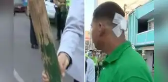 La Victoria: fiscalizadores golpean con palo de madera a joven que defendió a ambulante