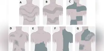 Los 'tatuajes' invisibles que posee cada persona desde el nacimiento: ¿cómo podemos verlos? Los 'tatuajes' invisibles que posee cada persona desde el nacimiento: ¿cómo podemos verlos?