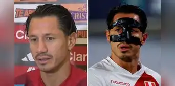 Gianluca Lapadula reveló el preocupante motivo por el que se volverá a operar la nariz