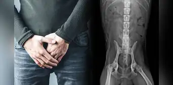 ¿Por qué los hombres son más vulnerables al cáncer que las mujeres? Estudio halla la causa