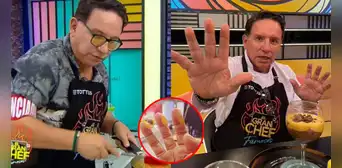 Así quedaron las manos de Ricardo Rondón tras quemaduras en "El gran chef": "Soy duro de matar"