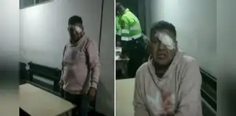 Ate: hombre pierde visión de un ojo por presunto abuso de autoridad policial, pero PNP lo niega Ate: hombre pierde visión de un ojo por presunto abuso de autoridad policial, pero PNP lo niega