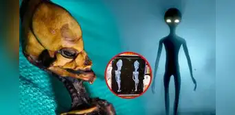 Los secretos de Ata, la supuesta 'momia extraterrestre' de Chile Los secretos de Ata, la supuesta 'momia extraterrestre' de Chile