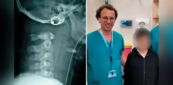 Médicos unen la cabeza al cuello de un niño que sufrió decapitación interna tras accidente Médicos unen la cabeza al cuello de un niño que sufrió decapitación interna tras accidente