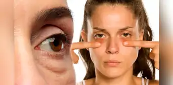 La poderosa planta que reduce la flacidez en la piel, ojeras y bolsas en los ojos