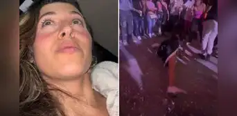 "No saben lo que estoy sufriendo": joven sale de fiesta y regresa con la pierna lesionada