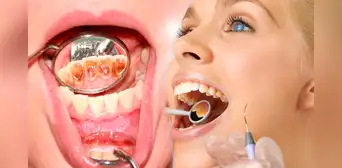 Elimina el sarro dental de forma natural consumiendo estas frutas Elimina el sarro dental de forma natural consumiendo estas frutas