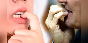 ¿Te muerdes las uñas mucho? Un estudio finalmente dio la técnica definitiva para dejar esta mania ¿Te muerdes las uñas mucho? Un estudio finalmente dio la técnica definitiva para dejar esta mania