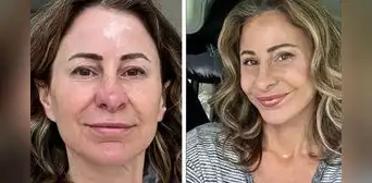 Mujer de 50 años vendió su casa para pagarse una cirugía facial y ahora vive en su camioneta Mujer de 50 años vendió su casa para pagarse una cirugía facial y ahora vive en su camioneta