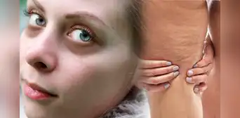 Mejora la apariencia de tus ojeras y reduce la celulitis con esta VITAMINA natural Mejora la apariencia de tus ojeras y reduce la celulitis con esta VITAMINA natural
