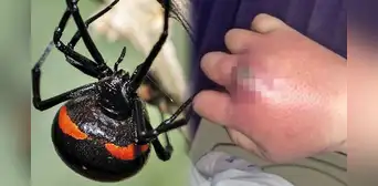 Niño queda grave tras dejarse picar por una araña viuda negra “para convertirse en Spiderman”