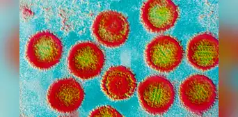 Resultados "prometedores" de una vacuna contra el virus que infecta al 95% de los adultos Resultados "prometedores" de una vacuna contra el virus que infecta al 95% de los adultos