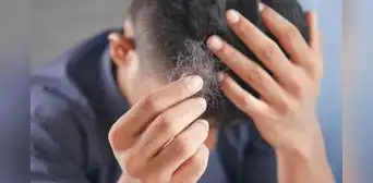 ¿Por qué se nos cae el cabello a pesar de ser jóvenes?