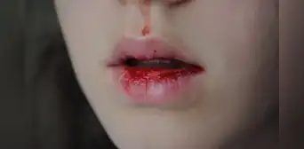 ¿Qué significa soñar con sangre que sale de la boca de otra persona? ¿Qué significa soñar con sangre que sale de la boca de otra persona?