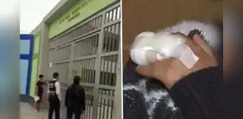 Comas: niña de 6 años pierde parte de un dedo tras sufrir accidente en su colegio Comas: niña de 6 años pierde parte de un dedo tras sufrir accidente en su colegio