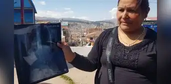Madre denuncia bullying después de que su hija sea hospitalizada tras ingerir grapa en colegio de Cusco
