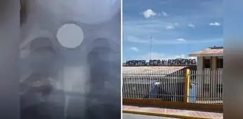 Niño de 4 años que ingirió moneda de S/1 se salva de morir tras ser sometido a cirugía en Puno Niño de 4 años que ingirió moneda de S/1 se salva de morir tras ser sometido a cirugía en Puno