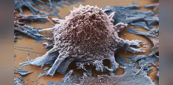 Científicos logran convertir tumores cancerosos en células sanas con tecnología genética Científicos logran convertir tumores cancerosos en células sanas con tecnología genética