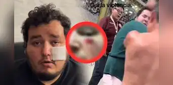 Hincha de Universitario denunció que le desfiguraron la cara en el Monumental en final femenina