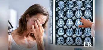 Mujer creyó que tenía orzuelo y le diagnostican que era tumor cerebral: “Quedé devastada” Mujer creyó que tenía orzuelo y le diagnostican que era tumor cerebral: “Quedé devastada”