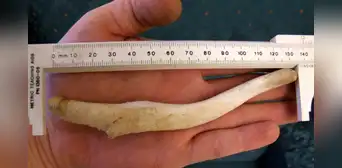 ¿Por qué los hombres perdieron el hueso del pene cuando evolucionaron?