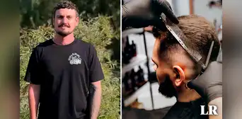 Joven va a cortarse el cabello y descubre que tiene cáncer de piel: le quedan 6 meses de vida Joven va a cortarse el cabello y descubre que tiene cáncer de piel: le quedan 6 meses de vida