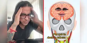 Sabías que el cerebro no siente dolor, entonces ¿qué origina el dolor de cabeza?