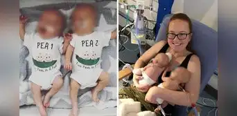 La insólita historia de una mujer que dio a luz a cada uno de sus mellizos con 2 días de diferencia La insólita historia de una mujer que dio a luz a cada uno de sus mellizos con 2 días de diferencia