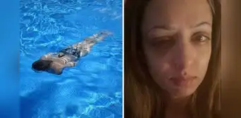 Mujer acudió a nadar a piscina pública y perdió la visión en un ojo: “El dolor más insoportable” Mujer acudió a nadar a piscina pública y perdió la visión en un ojo: “El dolor más insoportable”