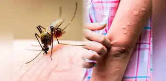 ¿Por qué hay tantos mosquitos en Arequipa y qué hacer para protegernos de ellos? ¿Por qué hay tantos mosquitos en Arequipa y qué hacer para protegernos de ellos?