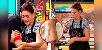 Tilsa Lozano sufrió fuerte quemadura de segundo grado en 'El gran chef: famosos' Tilsa Lozano sufrió fuerte quemadura de segundo grado en 'El gran chef: famosos'