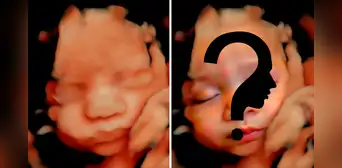 Usan tecnología de IA en ecografías de bebés para adivinar cómo serán sus rostros al nacer Usan tecnología de IA en ecografías de bebés para adivinar cómo serán sus rostros al nacer