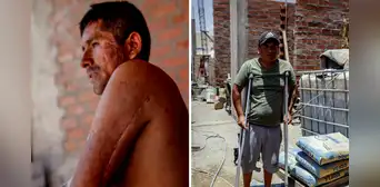 Las heridas de las protestas contra Dina Boluarte aún no se cierran Las heridas de las protestas contra Dina Boluarte aún no se cierran