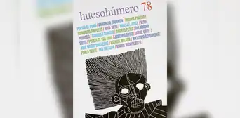 Impresiones acerca de Hueso Húmero 78