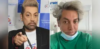 Koky Belaunde sobrevivió a dificil operación de riesgo: ¿qué pasó con el famoso maquillador? Koky Belaunde sobrevivió a dificil operación de riesgo: ¿qué pasó con el famoso maquillador?