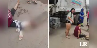 SJL: camión de basura atropella a mujer y ahora corre peligro de que le amputen el pie SJL: camión de basura atropella a mujer y ahora corre peligro de que le amputen el pie