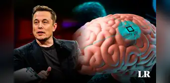 Musk anuncia primer implante cerebral de Neurolink en humanos: promete recuperar movimiento y visión
